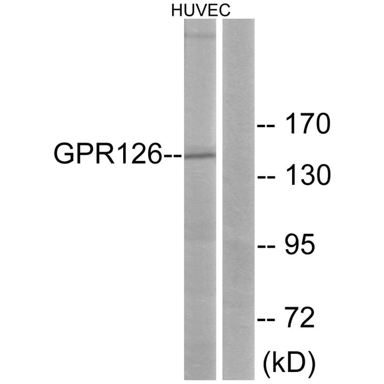 Western Blot - Anti-GPR126 Antibody (G290) - Antibodies.com