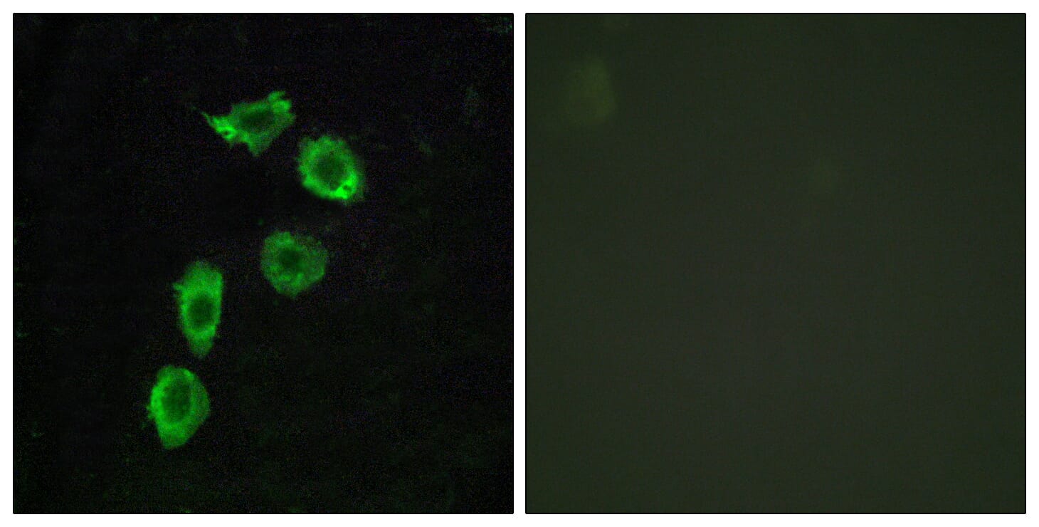 Immunofluorescence analysis of HUVEC cells using Anti-GPR123 Antibody. The right hand panel represents a negative control, where the antibody was pre-incubated with the immunising peptide.