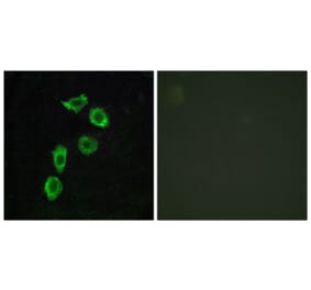 Immunofluorescence - Anti-GPR123 Antibody (G287) - Antibodies.com