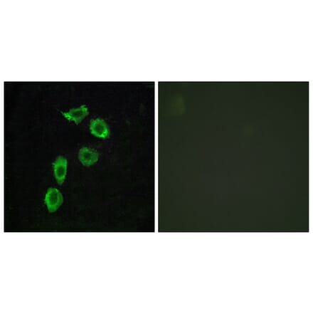 Immunofluorescence - Anti-GPR123 Antibody (G287) - Antibodies.com