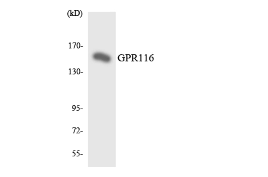 Western Blot - Anti-GPR116 Antibody (R12-2827) - Antibodies.com