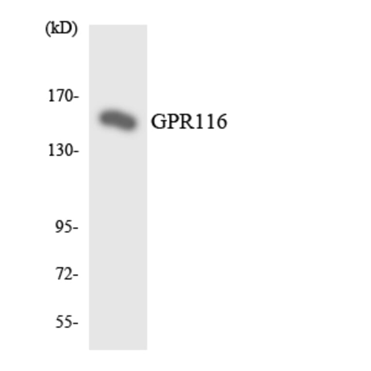 Western Blot - Anti-GPR116 Antibody (R12-2827) - Antibodies.com