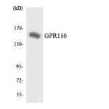 Western Blot - Anti-GPR116 Antibody (R12-2827) - Antibodies.com
