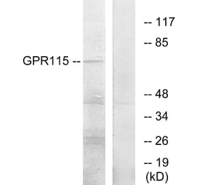 Western Blot - Anti-GPR115 Antibody (G285) - Antibodies.com