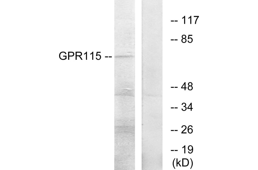 Western Blot - Anti-GPR115 Antibody (G285) - Antibodies.com