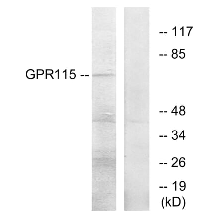 Western Blot - Anti-GPR115 Antibody (G285) - Antibodies.com