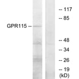 Western Blot - Anti-GPR115 Antibody (G285) - Antibodies.com