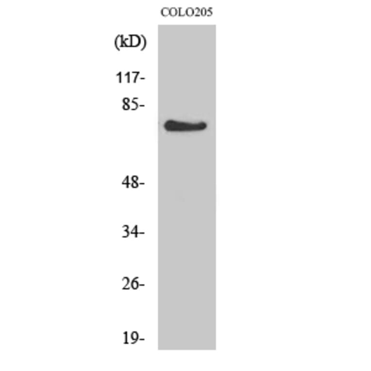 Western Blot - Anti-GPR115 Antibody (G285) - Antibodies.com