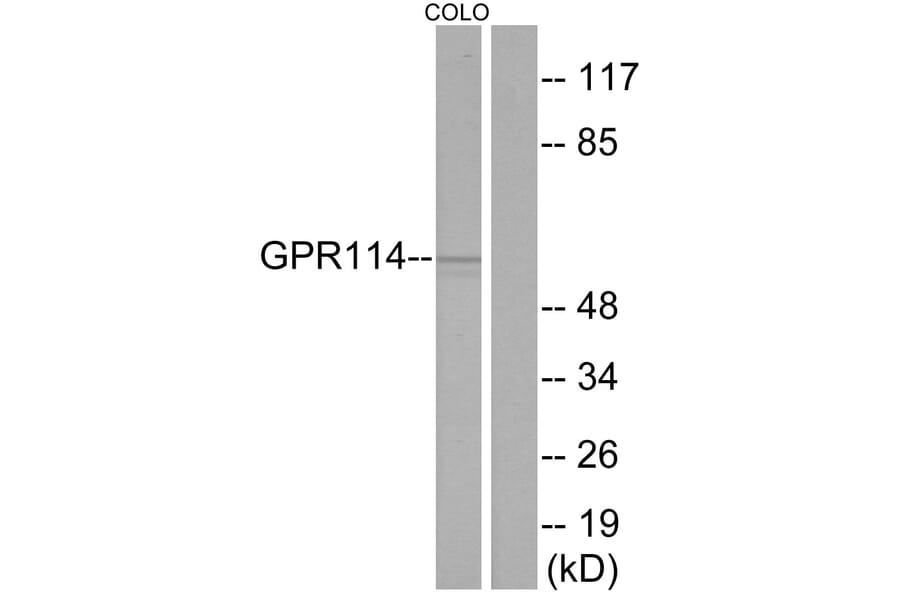 Western Blot - Anti-GPR114 Antibody (G284) - Antibodies.com