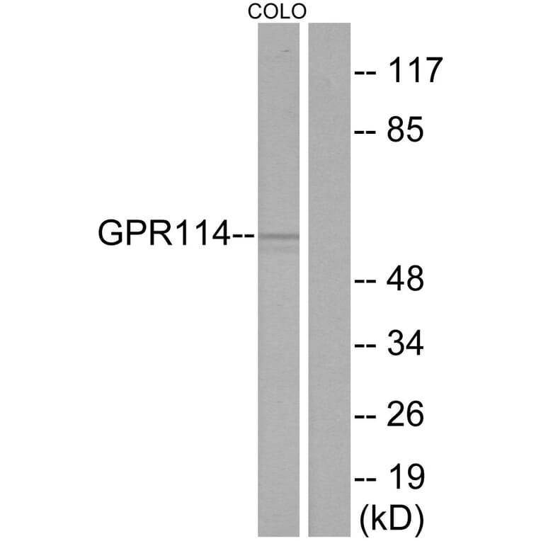 Western Blot - Anti-GPR114 Antibody (G284) - Antibodies.com