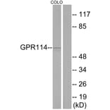 Western Blot - Anti-GPR114 Antibody (G284) - Antibodies.com
