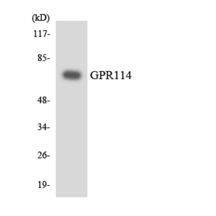 Western Blot - Anti-GPR114 Antibody (R12-2825) - Antibodies.com