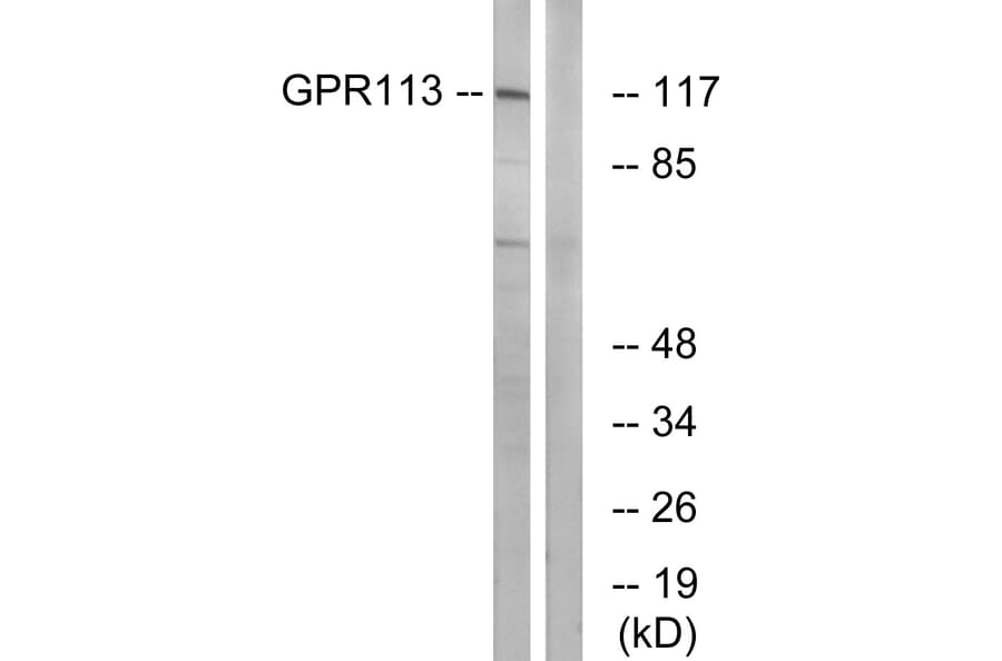 Western Blot - Anti-GPR113 Antibody (G283) - Antibodies.com