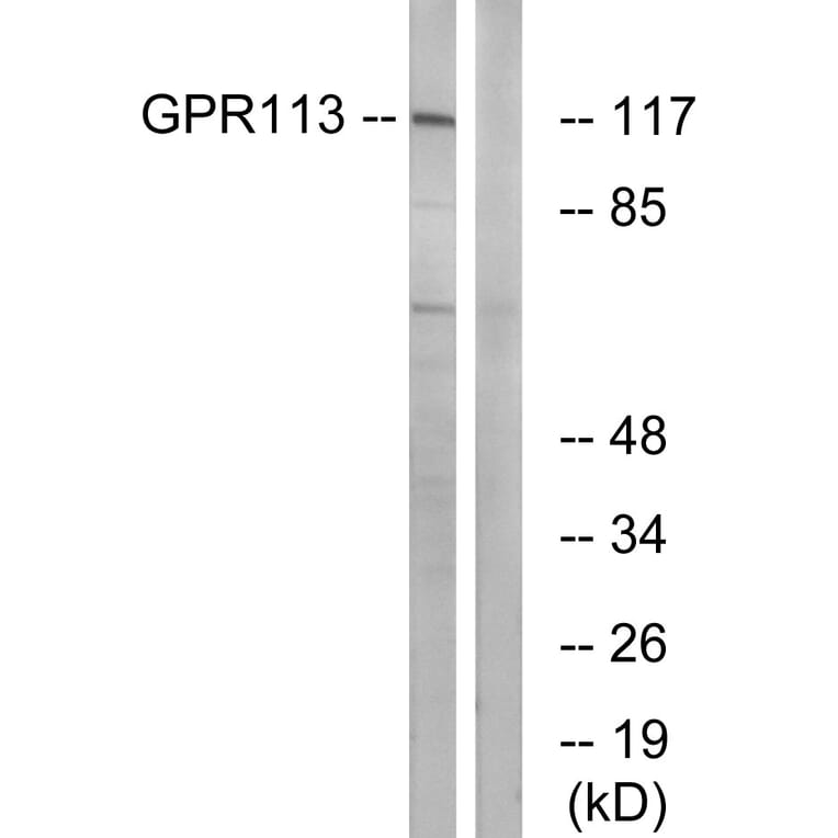 Western Blot - Anti-GPR113 Antibody (G283) - Antibodies.com