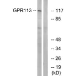 Western Blot - Anti-GPR113 Antibody (G283) - Antibodies.com