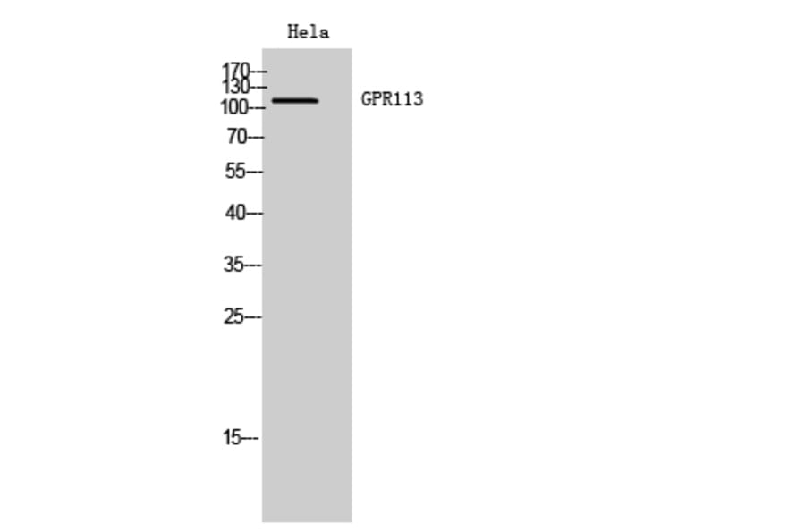 Western Blot - Anti-GPR113 Antibody (G283) - Antibodies.com