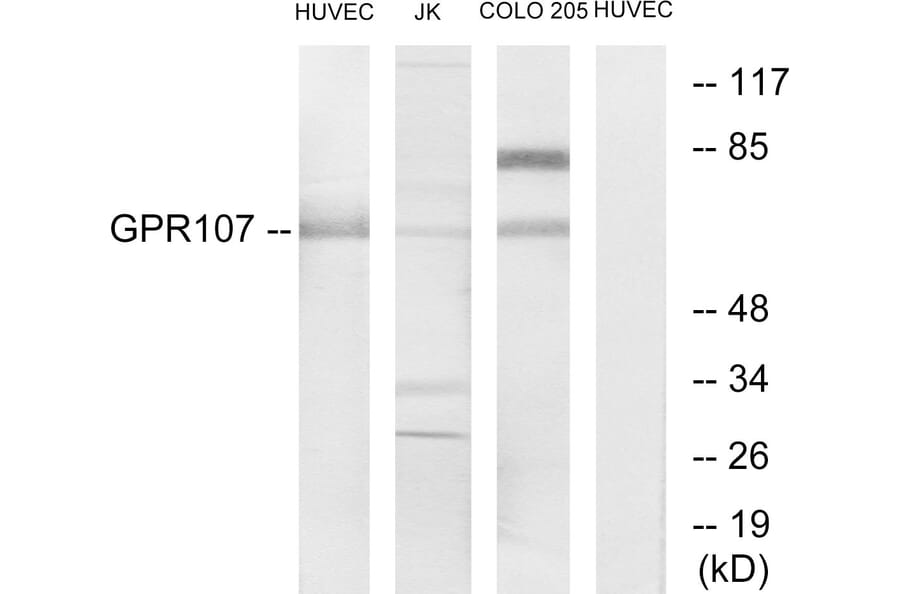 Western Blot - Anti-GPR107 Antibody (G279) - Antibodies.com
