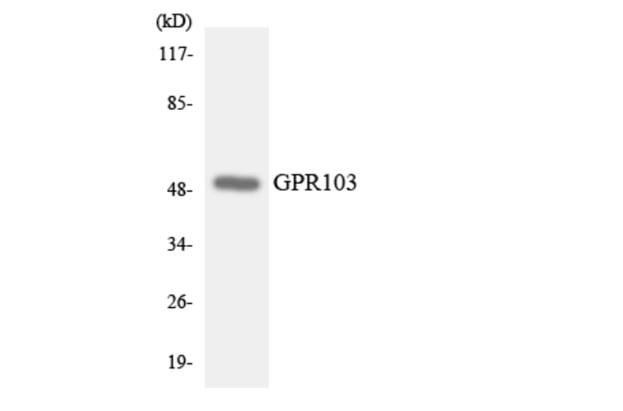 Western Blot - Anti-GPR103 Antibody (R12-2820) - Antibodies.com