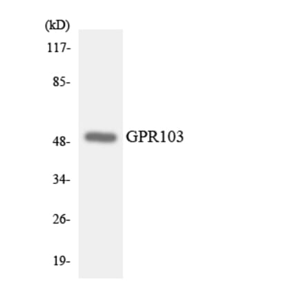Western Blot - Anti-GPR103 Antibody (R12-2820) - Antibodies.com