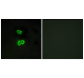 Immunofluorescence - Anti-GPR101 Antibody (G118) - Antibodies.com