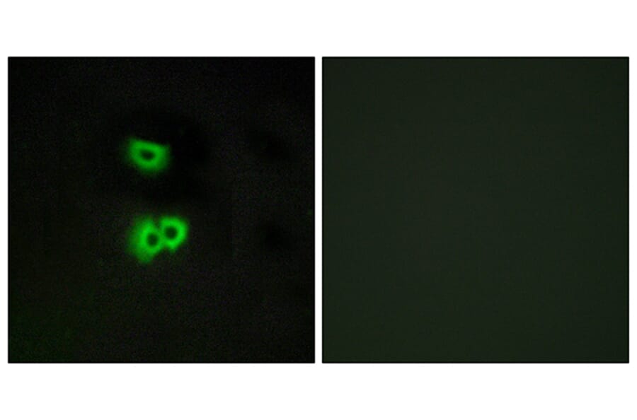 Immunofluorescence - Anti-GPR101 Antibody (G118) - Antibodies.com