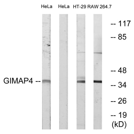 Western Blot - Anti-GIMAP4 Antibody (C16004) - Antibodies.com