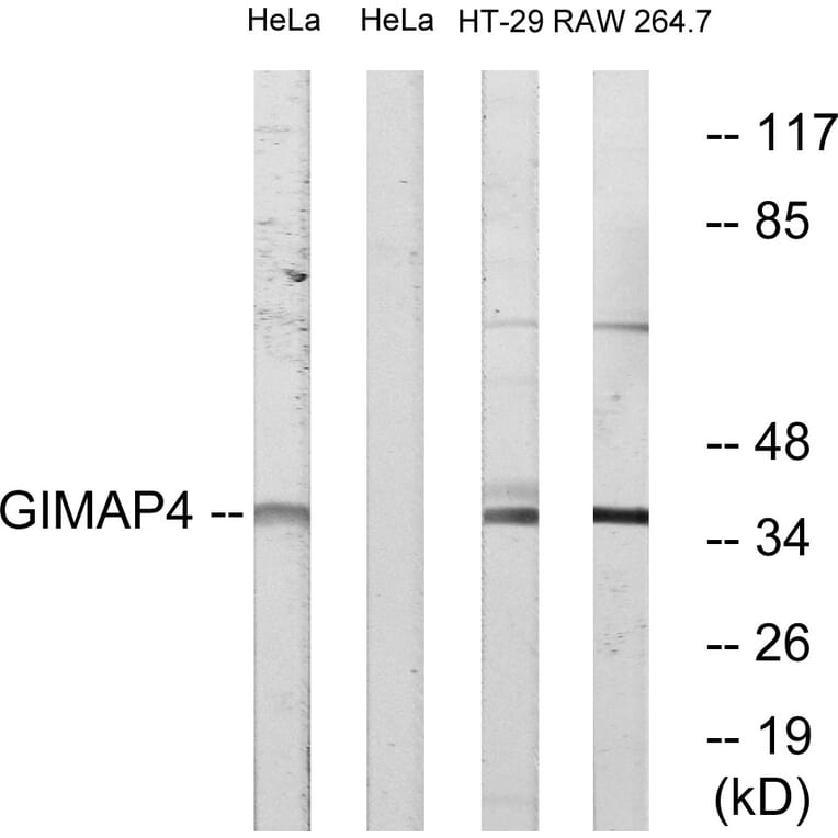 Western Blot - Anti-GIMAP4 Antibody (C16004) - Antibodies.com