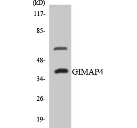 Western Blot - Anti-GIMAP4 Antibody (R12-2808) - Antibodies.com