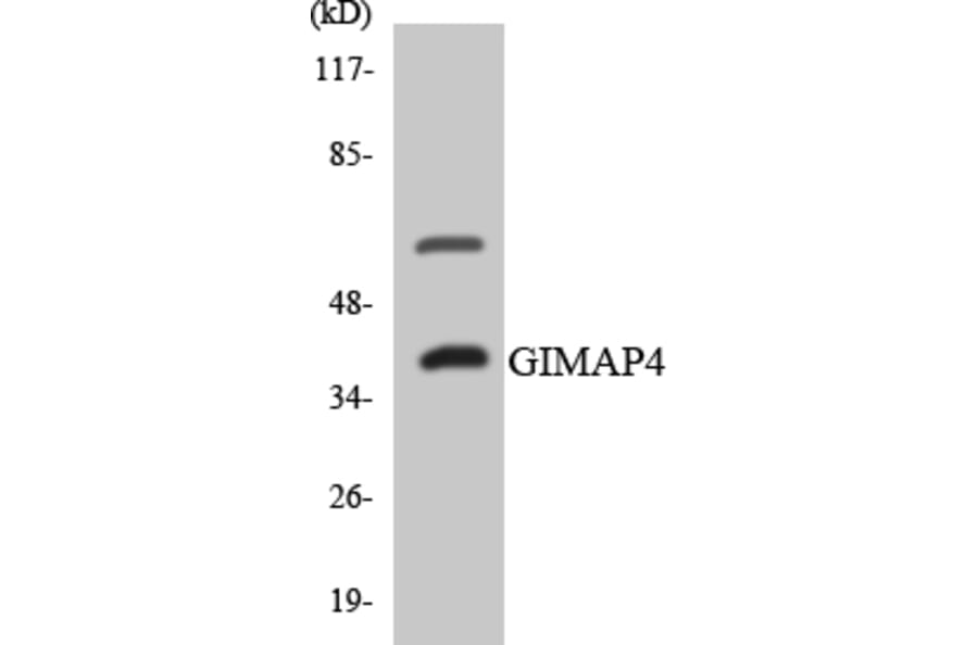 Western Blot - Anti-GIMAP4 Antibody (R12-2808) - Antibodies.com