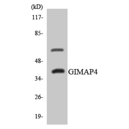 Western Blot - Anti-GIMAP4 Antibody (R12-2808) - Antibodies.com