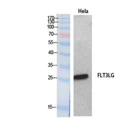 Western Blot - Anti-FLT3LG Antibody (C30133) - Antibodies.com
