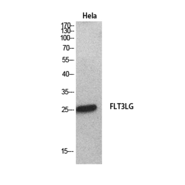 Western Blot - Anti-FLT3LG Antibody (C30133) - Antibodies.com