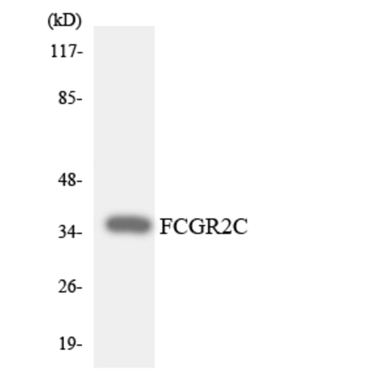 Western Blot - Anti-FCGR2C Antibody (R12-2767) - Antibodies.com