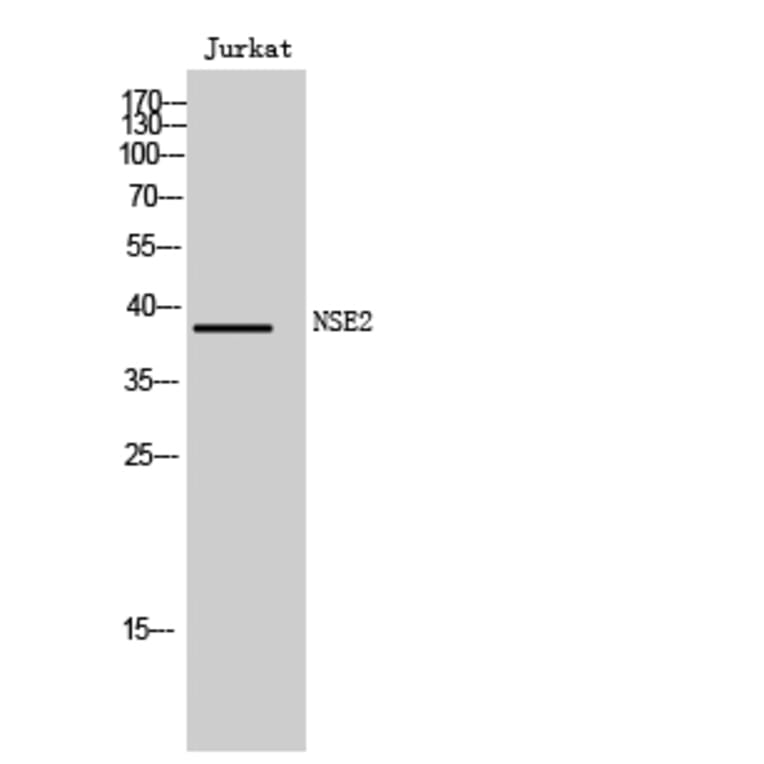 Western Blot - Anti-FAM84B Antibody (C11509) - Antibodies.com