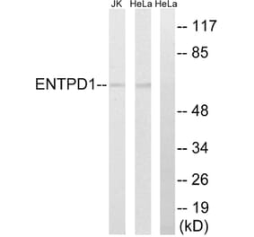 Western Blot - Anti-ENTPD1 Antibody (C15600) - Antibodies.com
