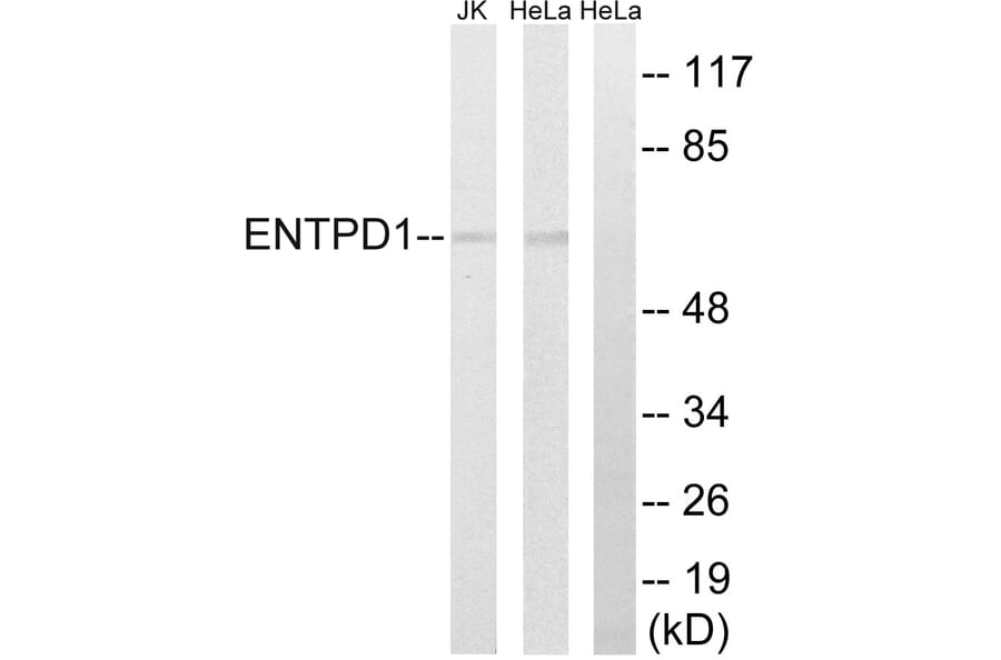 Western Blot - Anti-ENTPD1 Antibody (C15600) - Antibodies.com