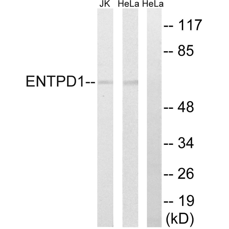 Western Blot - Anti-ENTPD1 Antibody (C15600) - Antibodies.com