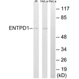 Western Blot - Anti-ENTPD1 Antibody (C15600) - Antibodies.com