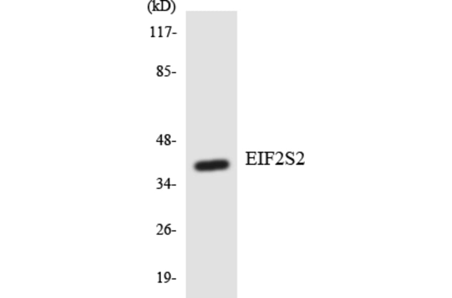 Western Blot - Anti-EIF2S2 Antibody (R12-2741) - Antibodies.com