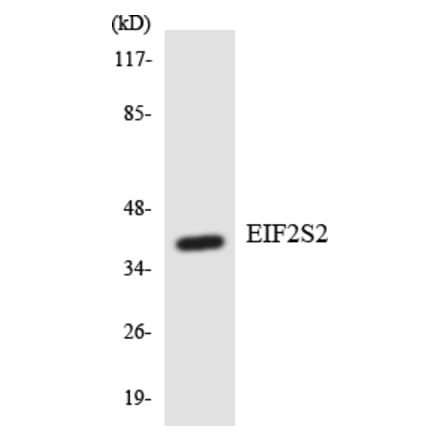 Western Blot - Anti-EIF2S2 Antibody (R12-2741) - Antibodies.com