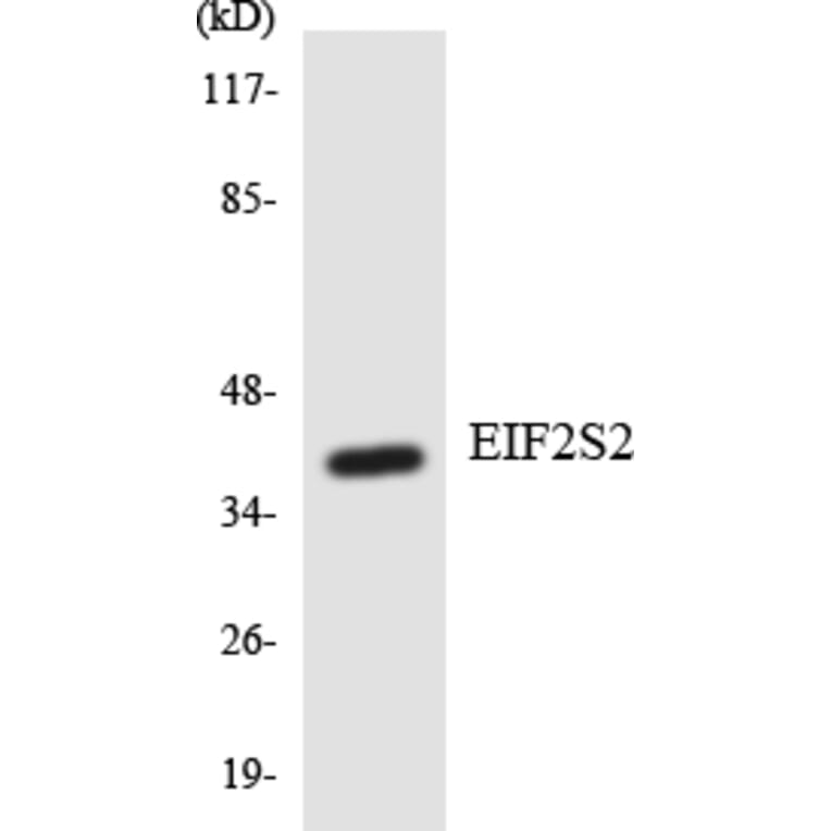 Western Blot - Anti-EIF2S2 Antibody (R12-2741) - Antibodies.com