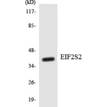 Western Blot - Anti-EIF2S2 Antibody (R12-2741) - Antibodies.com
