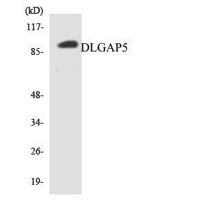 Western blot analysis of the lysates from HT 29 cells using Anti-DLGAP5 Antibody.