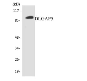 Western Blot - Anti-DLGAP5 Antibody (R12-2702) - Antibodies.com