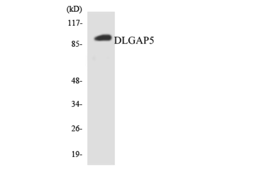 Western Blot - Anti-DLGAP5 Antibody (R12-2702) - Antibodies.com
