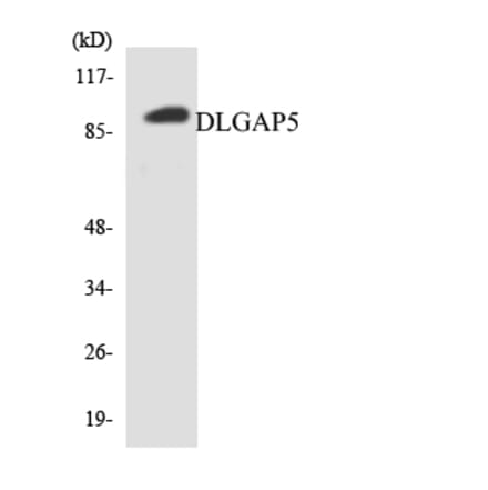 Western Blot - Anti-DLGAP5 Antibody (R12-2702) - Antibodies.com
