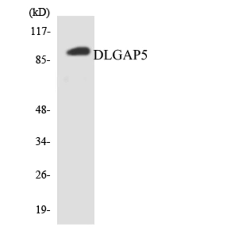 Western Blot - Anti-DLGAP5 Antibody (R12-2702) - Antibodies.com