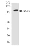 Western Blot - Anti-DLGAP5 Antibody (R12-2702) - Antibodies.com