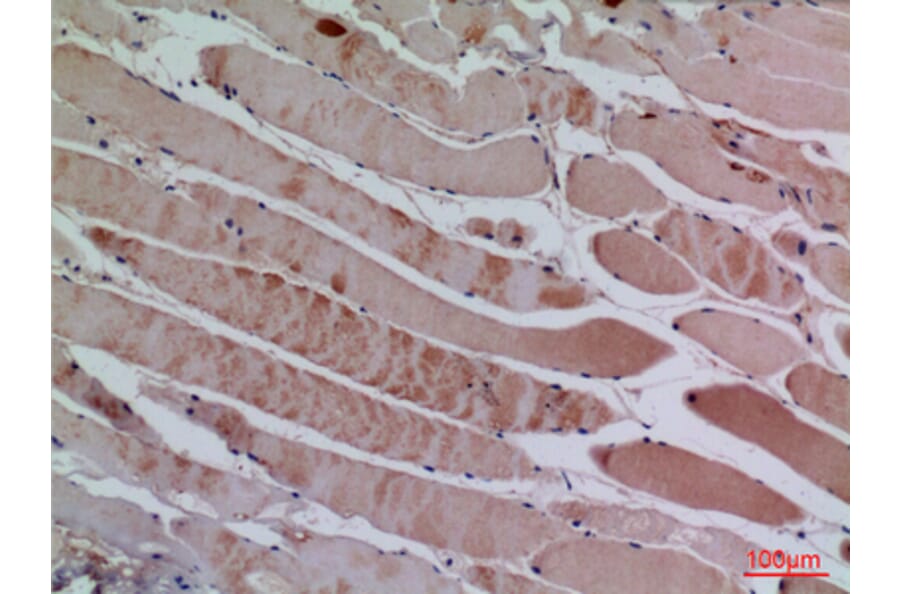 Immunohistochemistry - Anti-CXCL13 Antibody (C30177) - Antibodies.com