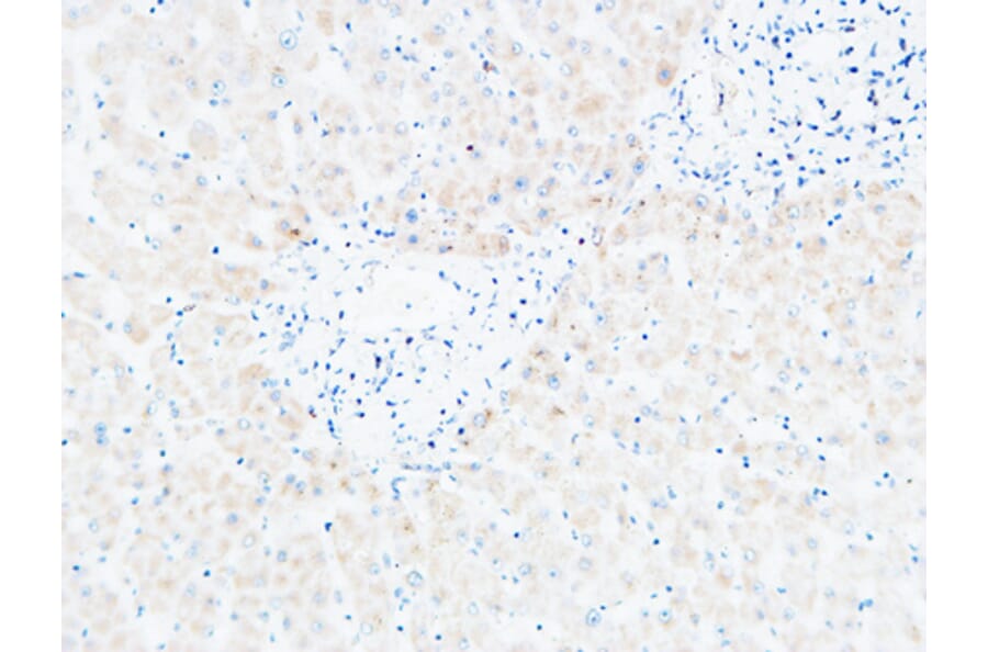 Immunohistochemistry - Anti-CXCL13 Antibody (C30177) - Antibodies.com